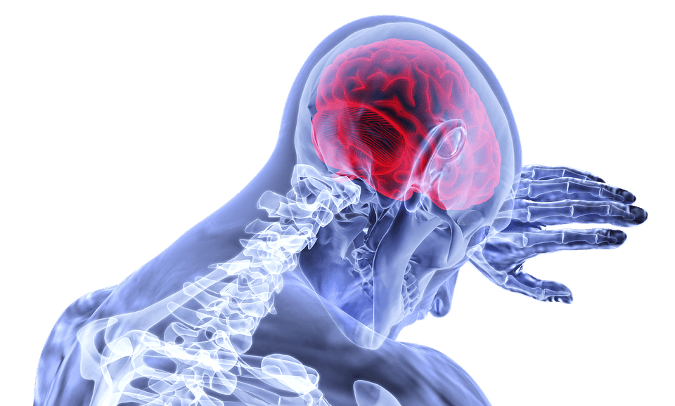 Apa Perbedaan Aneurisma dan Stroke?